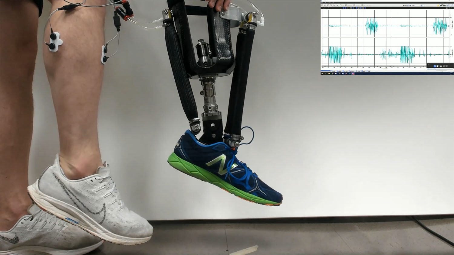 A human leg and a prosthetic leg